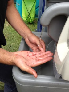 Irrigation with tap water before a laceration repair.