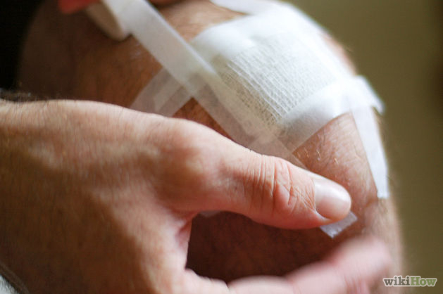 Dressing a Laceration