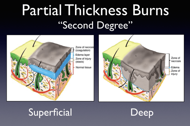 This cartoon depicts the varying pathology described by the term 