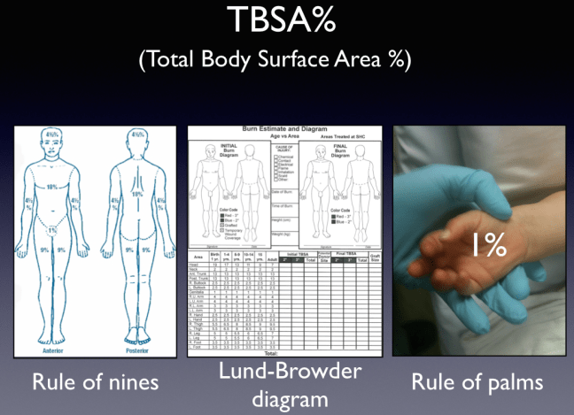 Traditional systems for burn TBSA assessment.