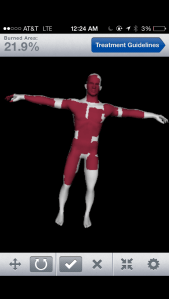 A 3D model can be rotated and space and marked with burn areas.