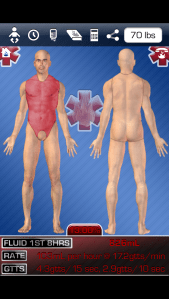 Adult burn calculation in uBurn Medic. Fluid resuscitation rates result on the same screen, with no additional clicks or swipes.
