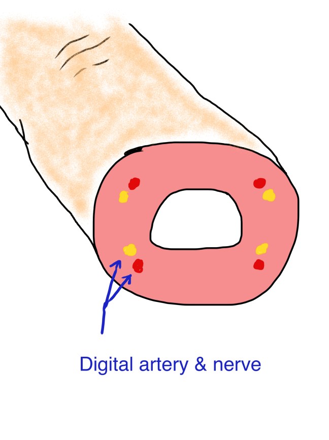 Digital nerves and arteries, depicted in cross section. 