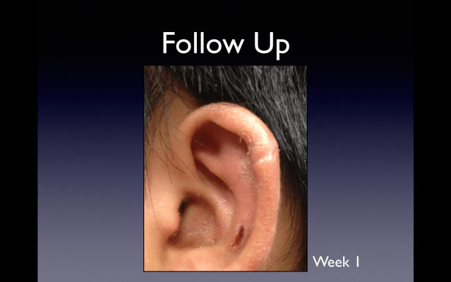 Follow up on the same ear laceration at one week.