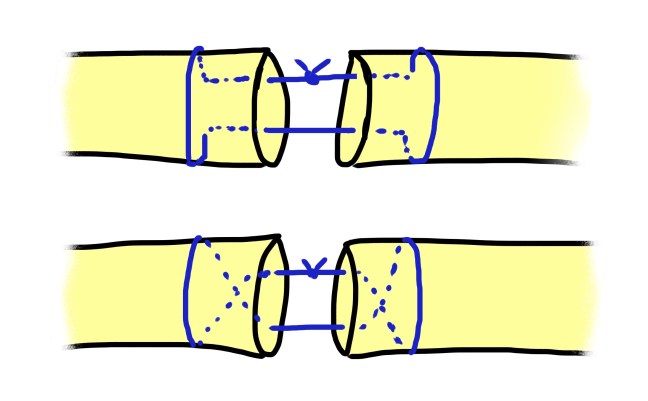 tendon suture cartoon