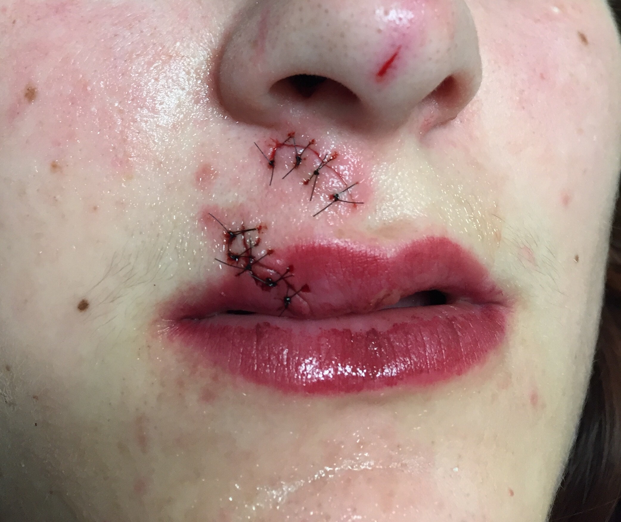 Dog Bite Dogma, Part II – Closing the Gap